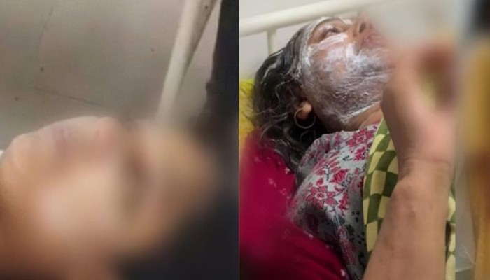 অগ্রিম দেওয়া গয়না চাইতে গিয়ে অ্যাসিড হামলার শিকার মা-মেয়ে